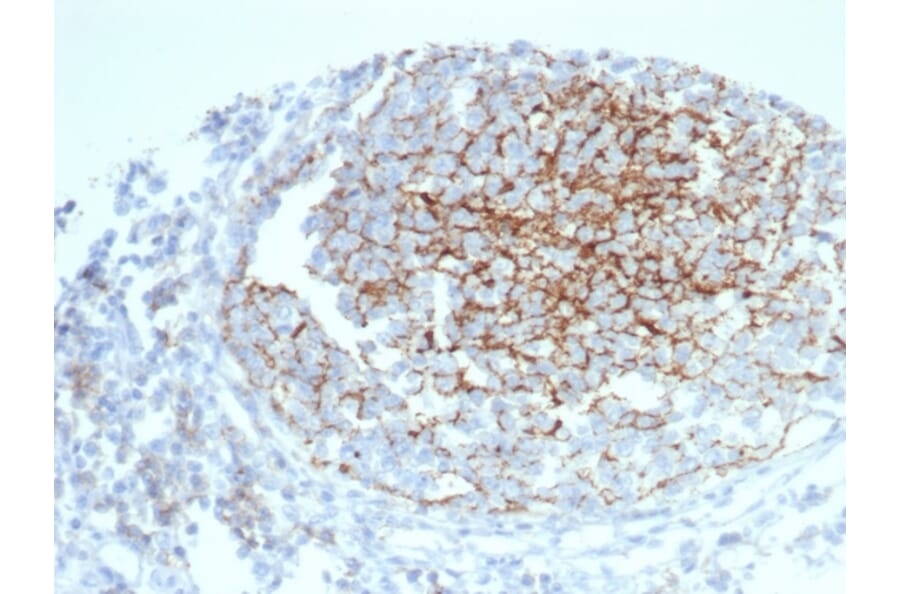 Immunohistochemistry - Anti-CD35 Antibody [CR1/6383] (A277561) - Antibodies.com