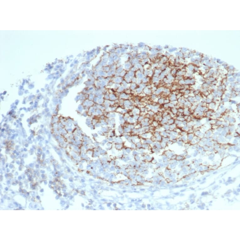 Immunohistochemistry - Anti-CD35 Antibody [CR1/6383] (A277561) - Antibodies.com