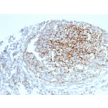 Immunohistochemistry - Anti-CD35 Antibody [CR1/6383] (A277561) - Antibodies.com