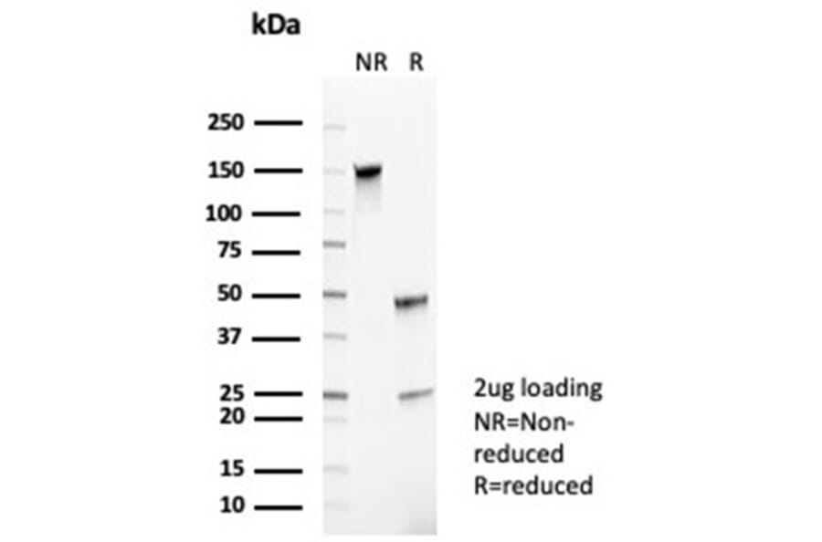 SDS-PAGE - Anti-CD35 Antibody [CR1/6385] (A277562) - Antibodies.com