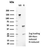 SDS-PAGE - Anti-CD35 Antibody [CR1/6385] (A277562) - Antibodies.com