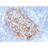 Immunohistochemistry - Anti-CD35 Antibody [CR1/6385] (A277562) - Antibodies.com