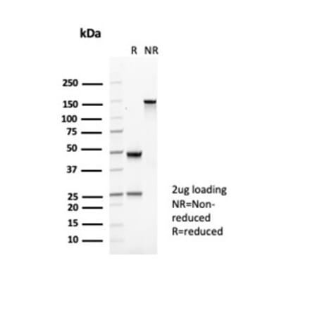 SDS-PAGE - Anti-CD35 Antibody [CR1/6377] (A277563) - Antibodies.com