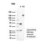 SDS-PAGE - Anti-CD35 Antibody [CR1/6377] (A277563) - Antibodies.com