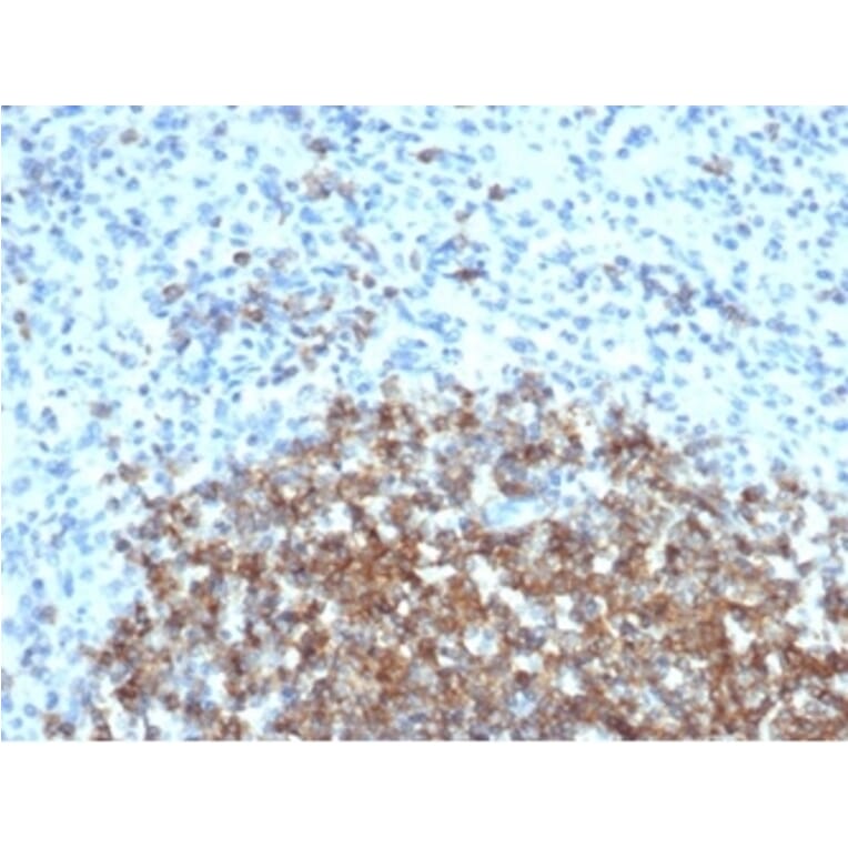 Immunohistochemistry - Anti-CD35 Antibody [CR1/6377] (A277563) - Antibodies.com