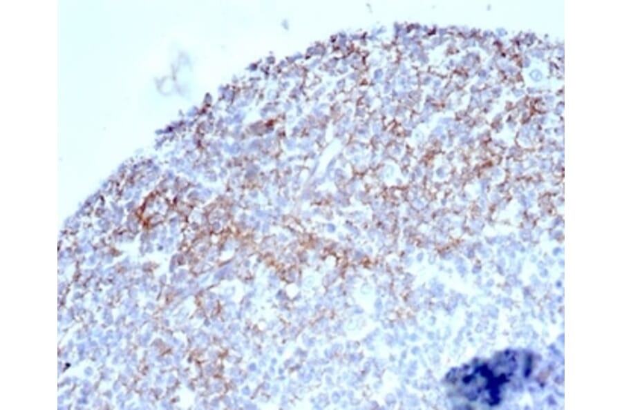 Immunohistochemistry - Anti-CD35 Antibody [CR1/6377] (A277563) - Antibodies.com