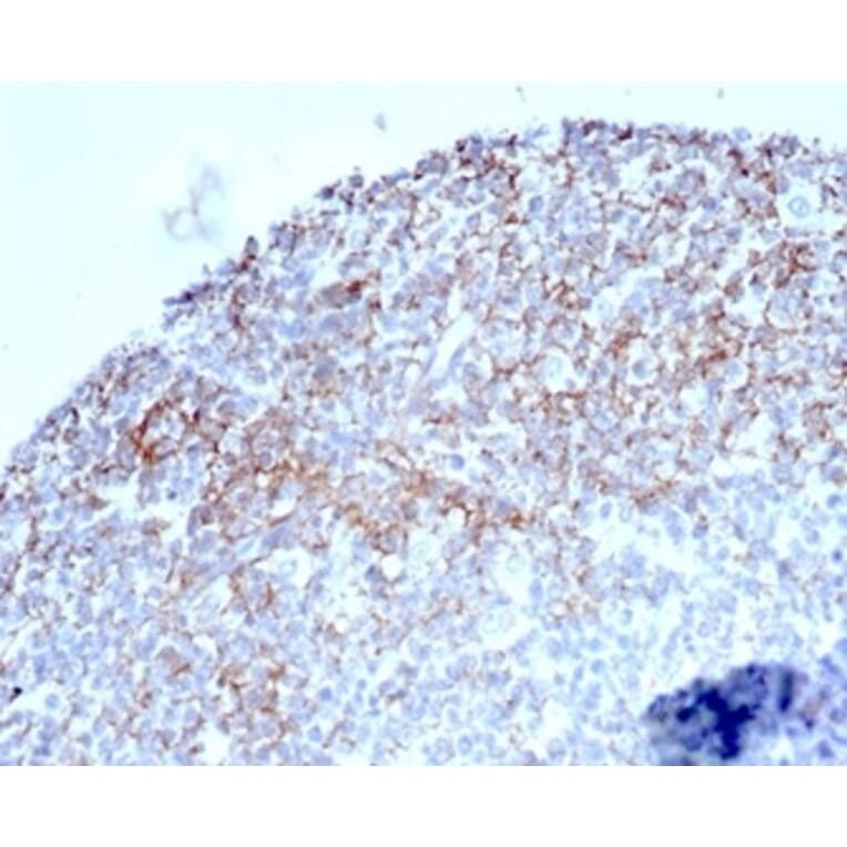 Immunohistochemistry - Anti-CD35 Antibody [CR1/6377] (A277563) - Antibodies.com