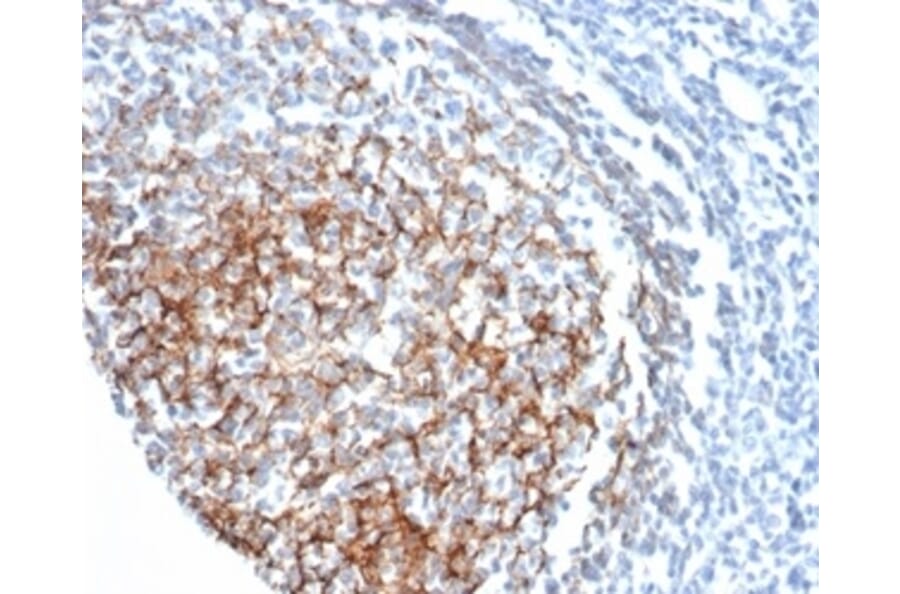 Immunohistochemistry - Anti-CD35 Antibody [CR1/6378] (A277564) - Antibodies.com