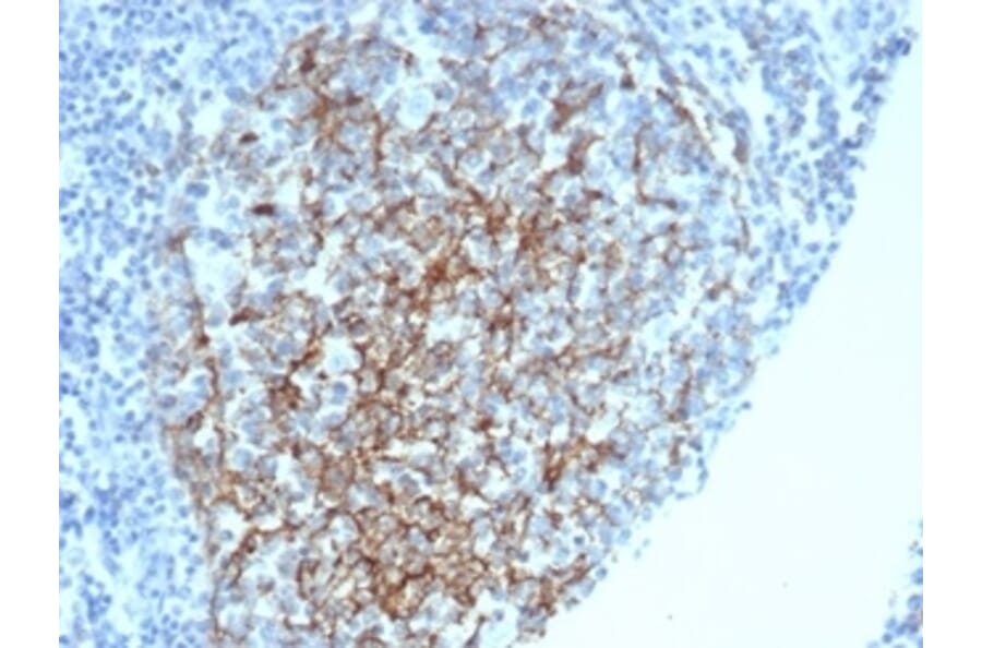 Immunohistochemistry - Anti-CD35 Antibody [CR1/6378] (A277564) - Antibodies.com