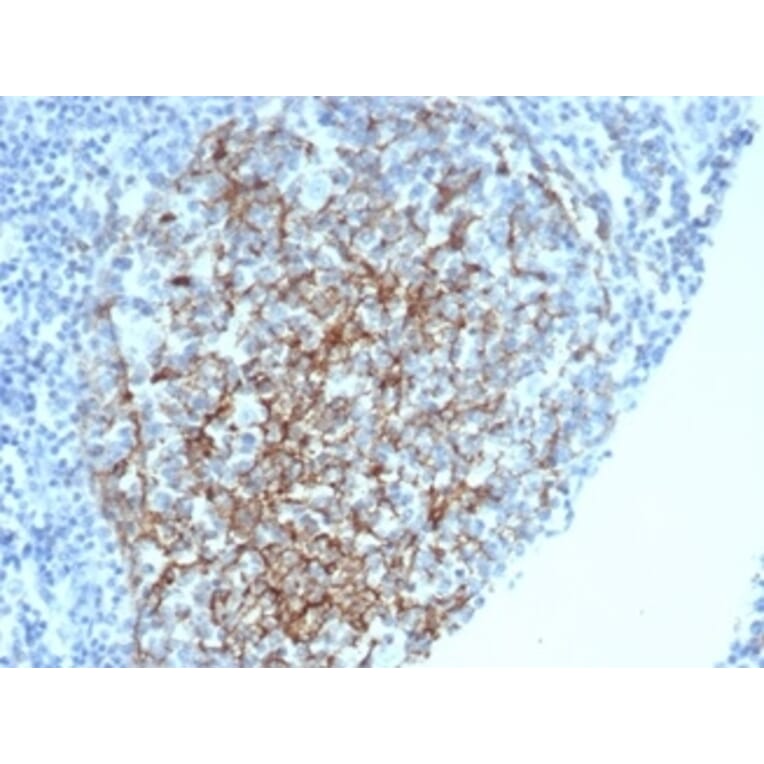 Immunohistochemistry - Anti-CD35 Antibody [CR1/6378] (A277564) - Antibodies.com