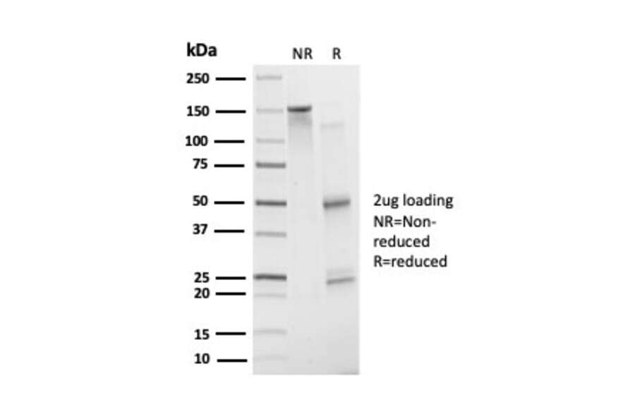 SDS-PAGE - Anti-ATF2 Antibody [PCRP-ATF2-1B4] (A277565) - Antibodies.com