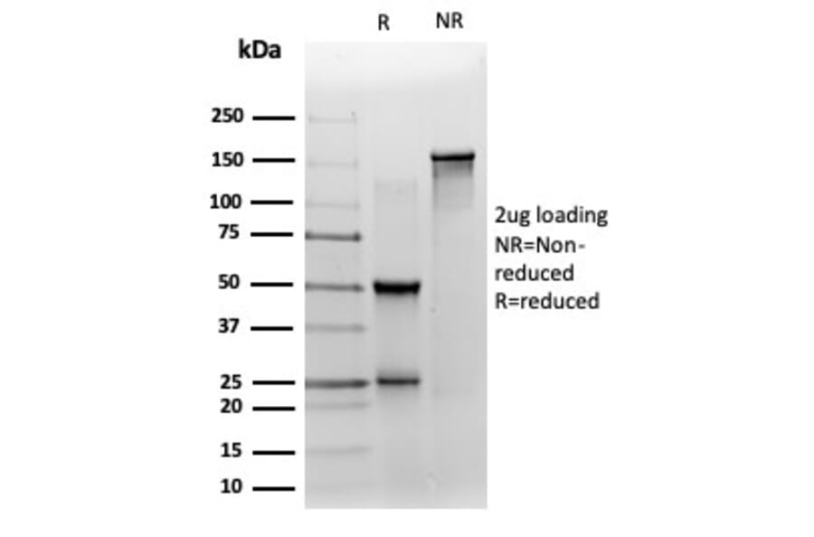 SDS-PAGE - Anti-ZNF358 Antibody [PCRP-ZNF358-1A6] (A277566) - Antibodies.com