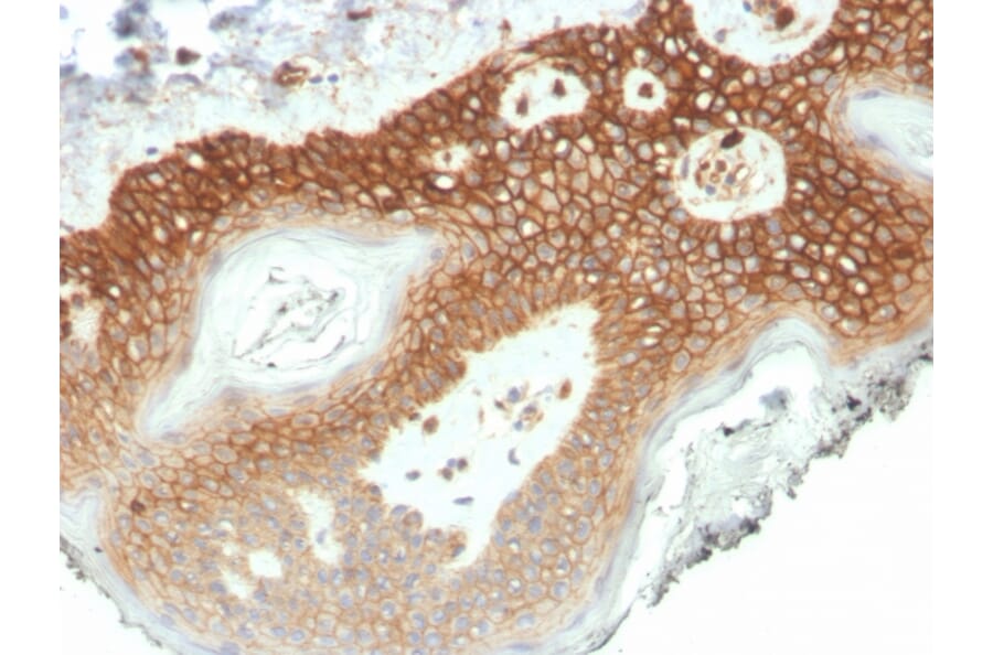 Immunohistochemistry - Anti-delta 1 Catenin Antibody [CTNND1/4501] (A277567) - Antibodies.com