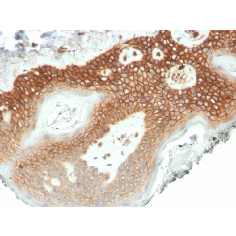 Immunohistochemistry - Anti-delta 1 Catenin Antibody [CTNND1/4501] (A277567) - Antibodies.com