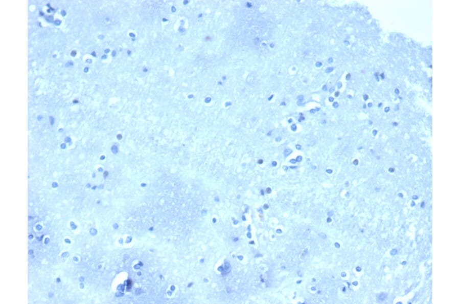 Immunohistochemistry - Anti-delta 1 Catenin Antibody [CTNND1/4501] (A277567) - Antibodies.com