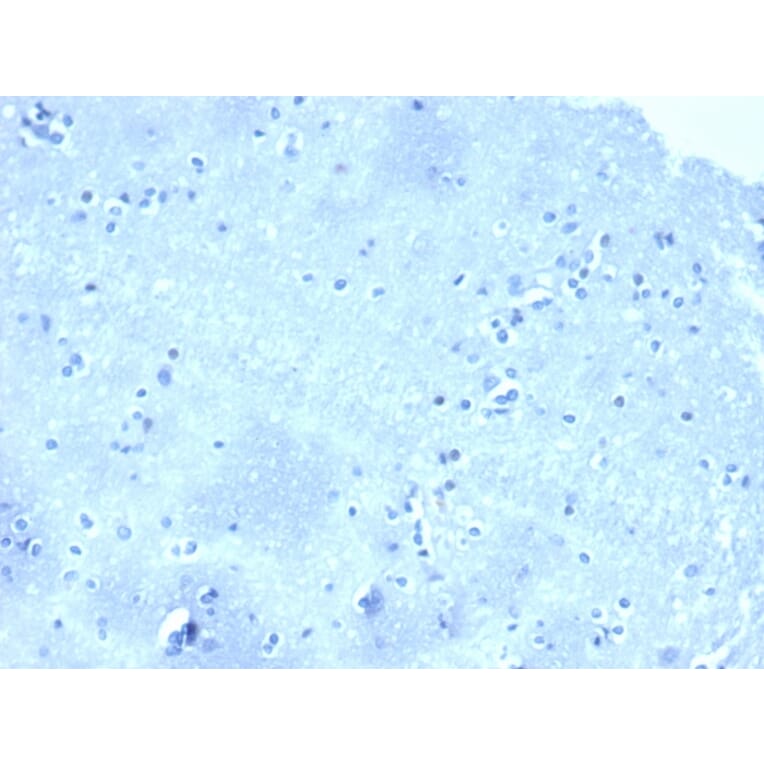 Immunohistochemistry - Anti-delta 1 Catenin Antibody [CTNND1/4501] (A277567) - Antibodies.com