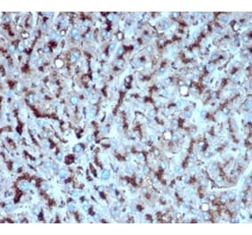 Immunohistochemistry - Anti-Cathepsin D Antibody [CTSD/4497] (A277569) - Antibodies.com