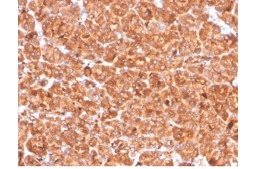 Immunohistochemistry - Anti-Cathepsin D Antibody [CTSD/4497] (A277569) - Antibodies.com