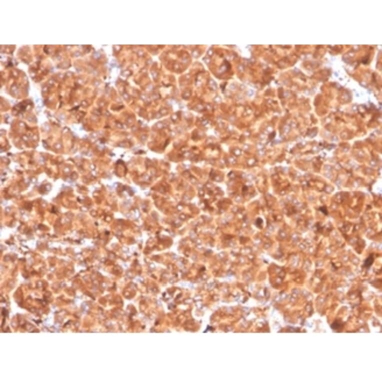 Immunohistochemistry - Anti-Cathepsin D Antibody [CTSD/4497] (A277569) - Antibodies.com