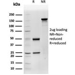 SDS-PAGE - Anti-Cathepsin D Antibody [CTSD/4497] (A277569) - Antibodies.com