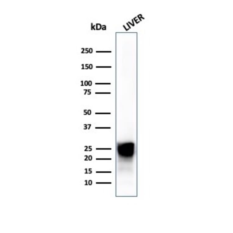 Western Blot - Anti-Cathepsin D Antibody [CTSD/4497] (A277569) - Antibodies.com