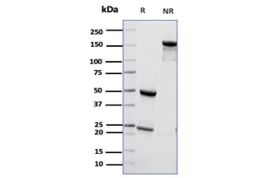 SDS-PAGE - Anti-CD55 Antibody [CD55/6795] (A277570) - Antibodies.com