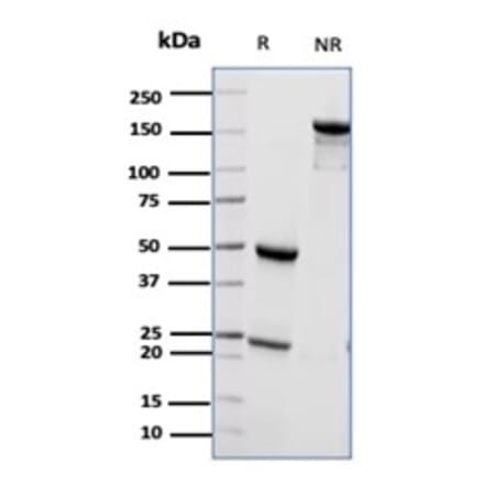 SDS-PAGE - Anti-CD55 Antibody [CD55/6795] (A277570) - Antibodies.com