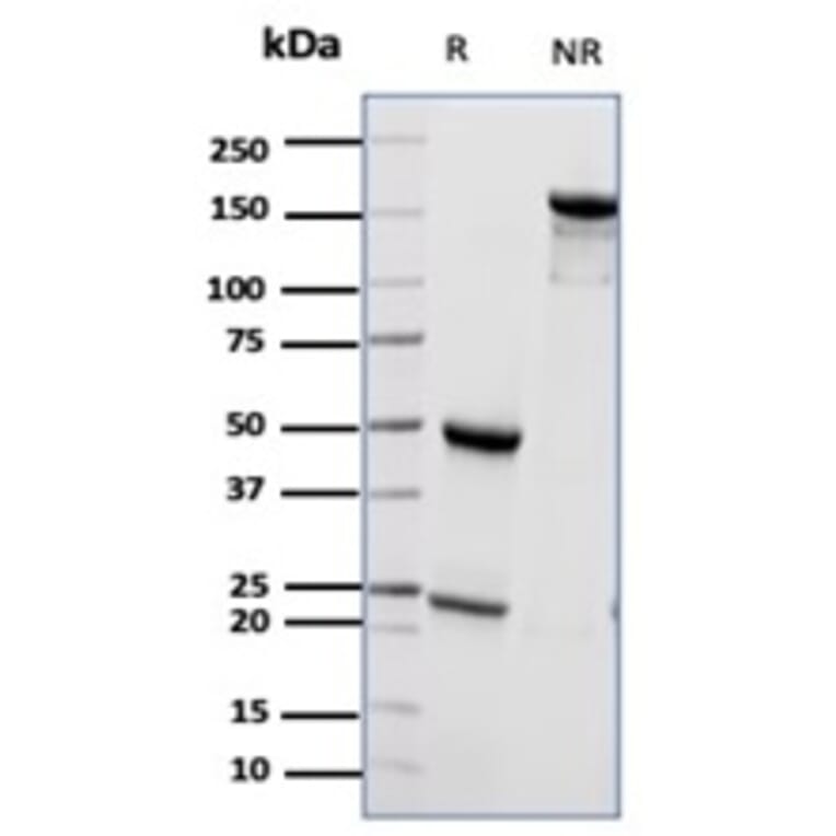 SDS-PAGE - Anti-CD55 Antibody [CD55/6795] (A277570) - Antibodies.com