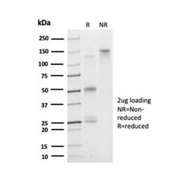 SDS-PAGE - Anti-DAXX Antibody [PCRP-DAXX-5G11] (A277571) - Antibodies.com