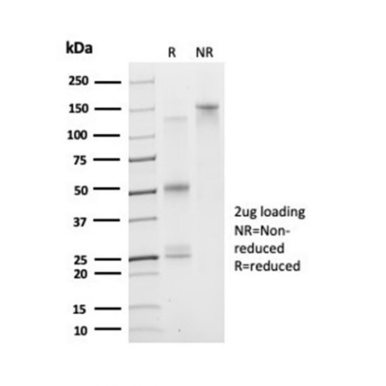 SDS-PAGE - Anti-DAXX Antibody [PCRP-DAXX-5G11] (A277571) - Antibodies.com