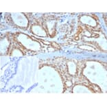 Immunohistochemistry - Anti-DAXX Antibody [PCRP-DAXX-5G11] (A277571) - Antibodies.com