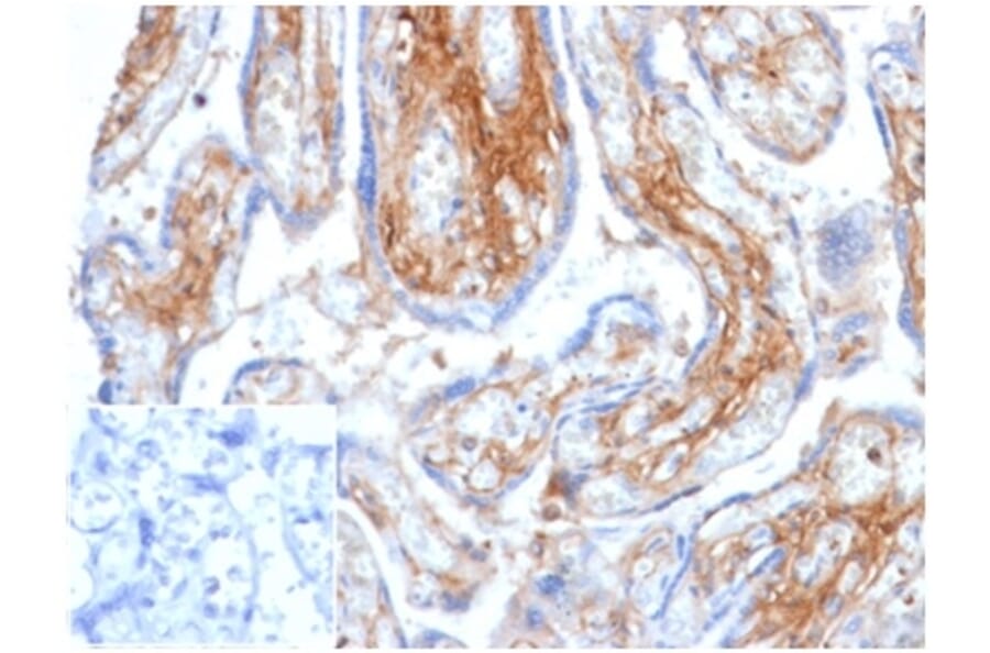 Immunohistochemistry - Anti-Decorin Antibody [DCN/6289] (A277573) - Antibodies.com