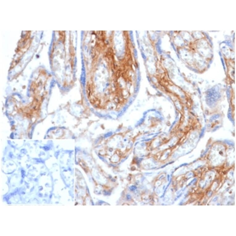 Immunohistochemistry - Anti-Decorin Antibody [DCN/6289] (A277573) - Antibodies.com