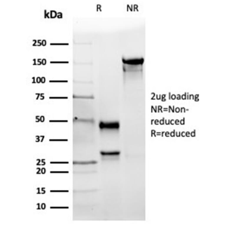 SDS-PAGE - Anti-Angiotensin Converting Enzyme 1 Antibody [ACE/3764] (A277574) - Antibodies.com