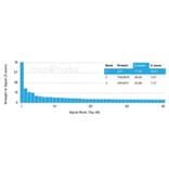 Protein Array - Anti-Angiotensin Converting Enzyme 1 Antibody [ACE/3764] (A277574) - Antibodies.com