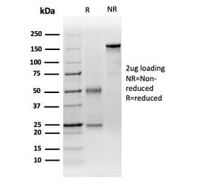 SDS-PAGE - Anti-DCP2 Antibody [PCRP-DCP2-1D6] (A277575) - Antibodies.com
