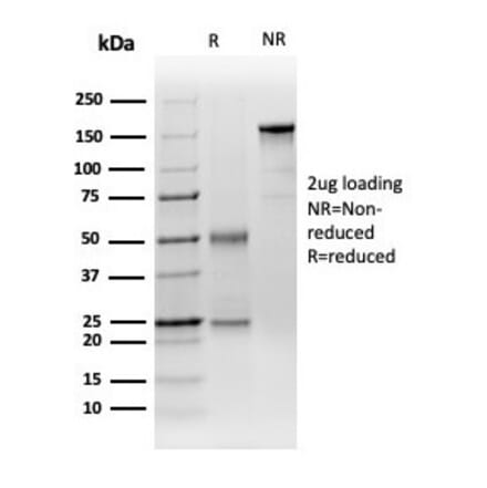 SDS-PAGE - Anti-DCP2 Antibody [PCRP-DCP2-1D6] (A277575) - Antibodies.com