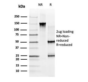 SDS-PAGE - Anti-GLIS3 Antibody [PCRP-GLIS3-1B11] (A277579) - Antibodies.com