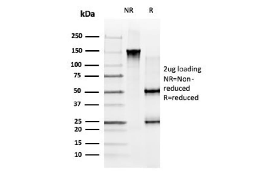 SDS-PAGE - Anti-GLIS3 Antibody [PCRP-GLIS3-1B11] (A277579) - Antibodies.com