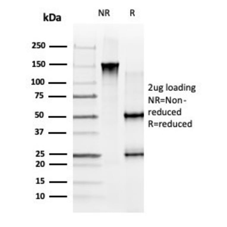 SDS-PAGE - Anti-GLIS3 Antibody [PCRP-GLIS3-1B11] (A277579) - Antibodies.com