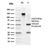 SDS-PAGE - Anti-GLIS3 Antibody [PCRP-GLIS3-1B11] (A277579) - Antibodies.com