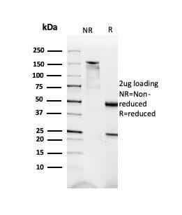 Anti-Dystrophin Antibody [DMD/3676] (A277580) | Antibodies.com