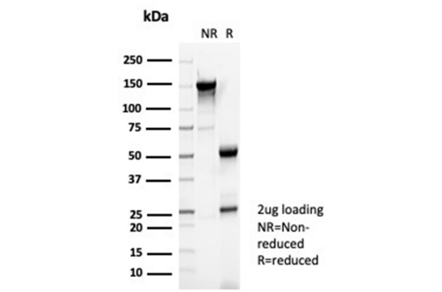 SDS-PAGE - Anti-Reelin Antibody [RELN/4498] (A277582) - Antibodies.com