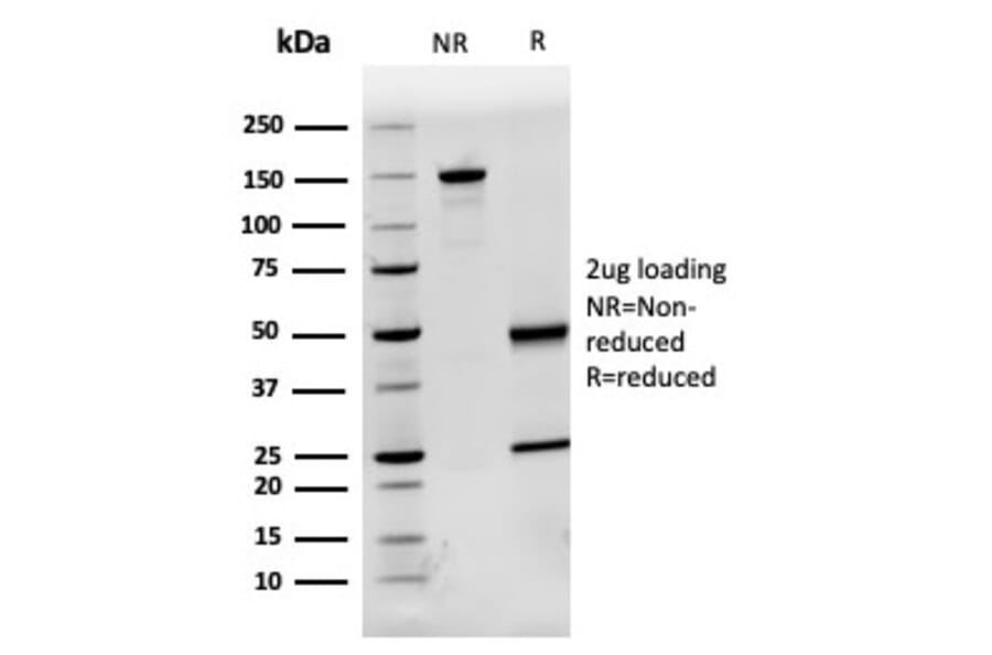 SDS-PAGE - Anti-AHSG Antibody [AHSG/3748] (A277583) - Antibodies.com