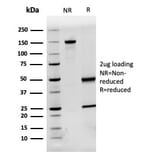 SDS-PAGE - Anti-AHSG Antibody [AHSG/3748] (A277583) - Antibodies.com