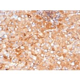 Immunohistochemistry - Anti-alpha 2 Macroglobulin Antibody [A2M/3622] (A277584) - Antibodies.com