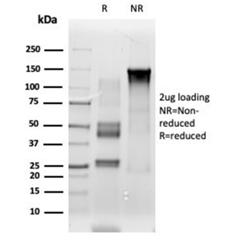 SDS-PAGE - Anti-ETS2 Antibody [PCRP-ETS2-1D9] (A277585) - Antibodies.com