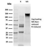 SDS-PAGE - Anti-ETS2 Antibody [PCRP-ETS2-1D9] (A277585) - Antibodies.com