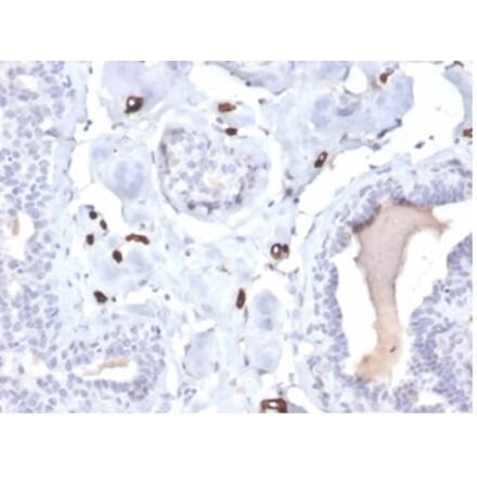 Immunohistochemistry - Anti-FABP4 Antibody [FABP4/4422] (A277586) - Antibodies.com