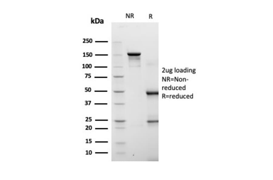 SDS-PAGE - Anti-FABP4 Antibody [FABP4/4422] (A277586) - Antibodies.com